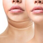 6 Easy Double Chin Exercises You Need To Know