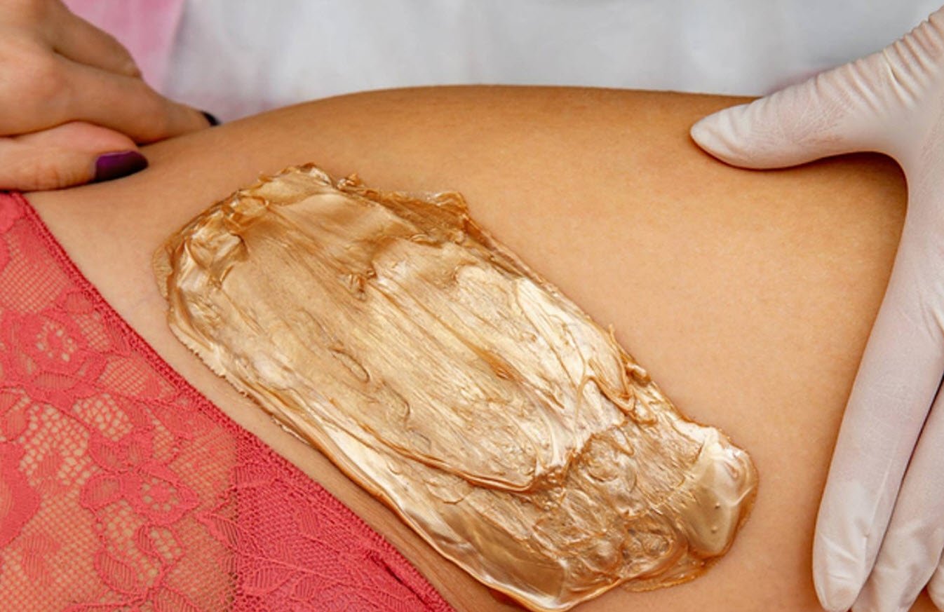 Bikini Waxing Bikini hair removal